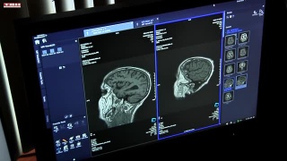 Новый томограф в онкодиспансере